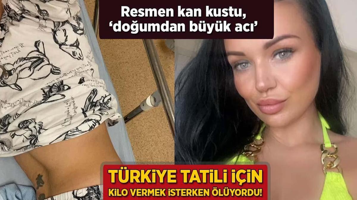 Türkiye tatili için kilo vermek isterken ölüyordu! Resmen kan kustu, ‘doğumdan büyük acı’